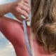 Sunburn Remedies