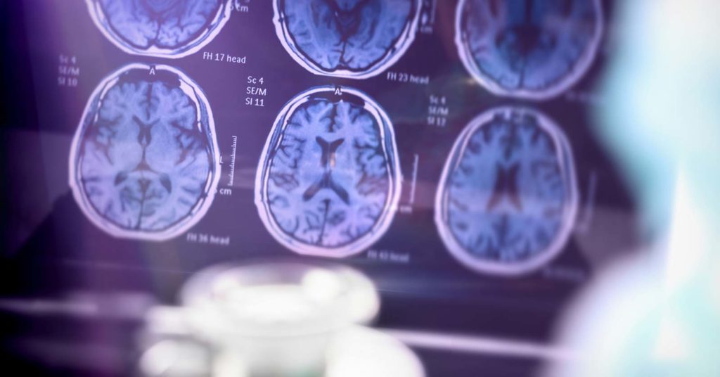 Alzheimers and Brain Awareness Month