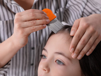 Treating and Preventing Head Lice In Children