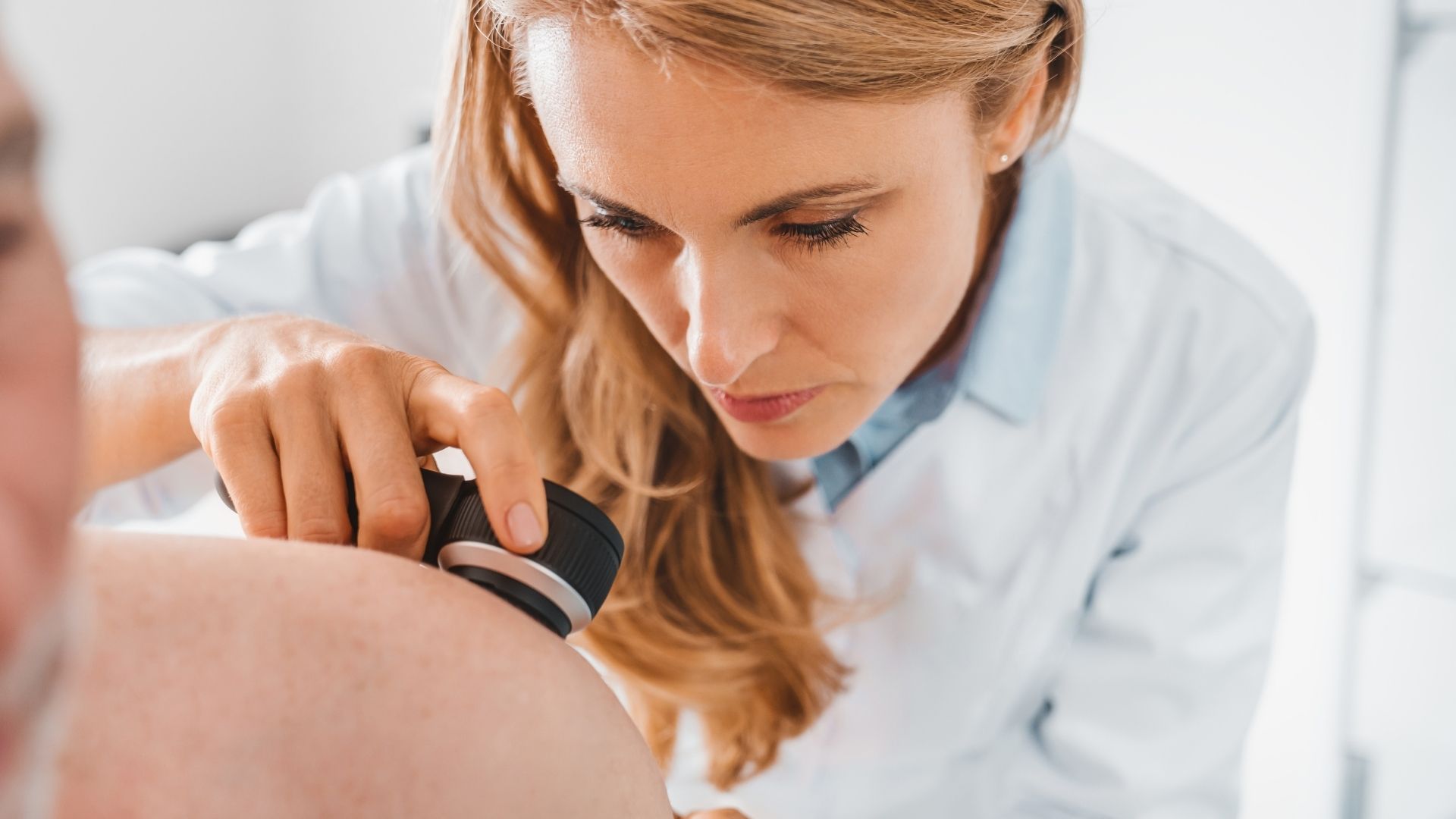 Skin Cancer Prevention