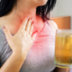 Gastroesophageal Reflux Disease (GERD)