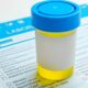 The Significance of Urinalysis in Emergency Medicine: Swift Answers Can Save Lives